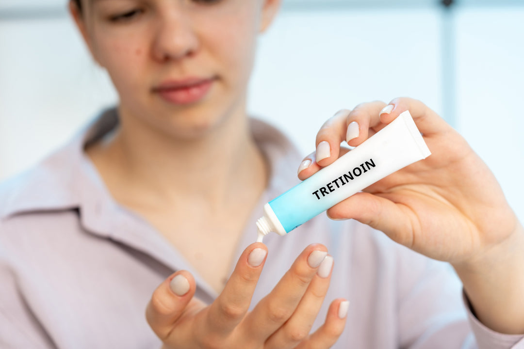 A woman with a small tube of tretinoin putting a small amount of cream on her finger