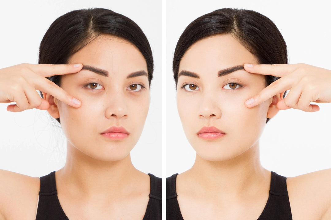 Side-by-side before and after close-up of a woman's face showing skincare results with improved skin tone and texture