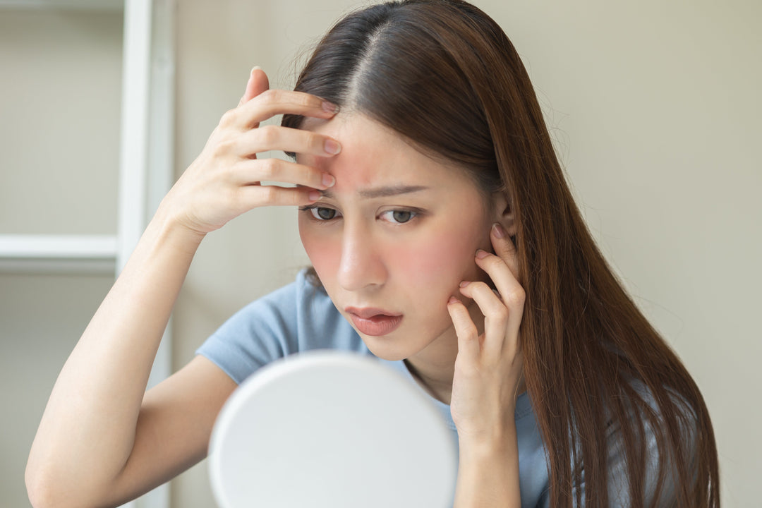 Young asian woman looking in a mirror worried about her red irritated skin