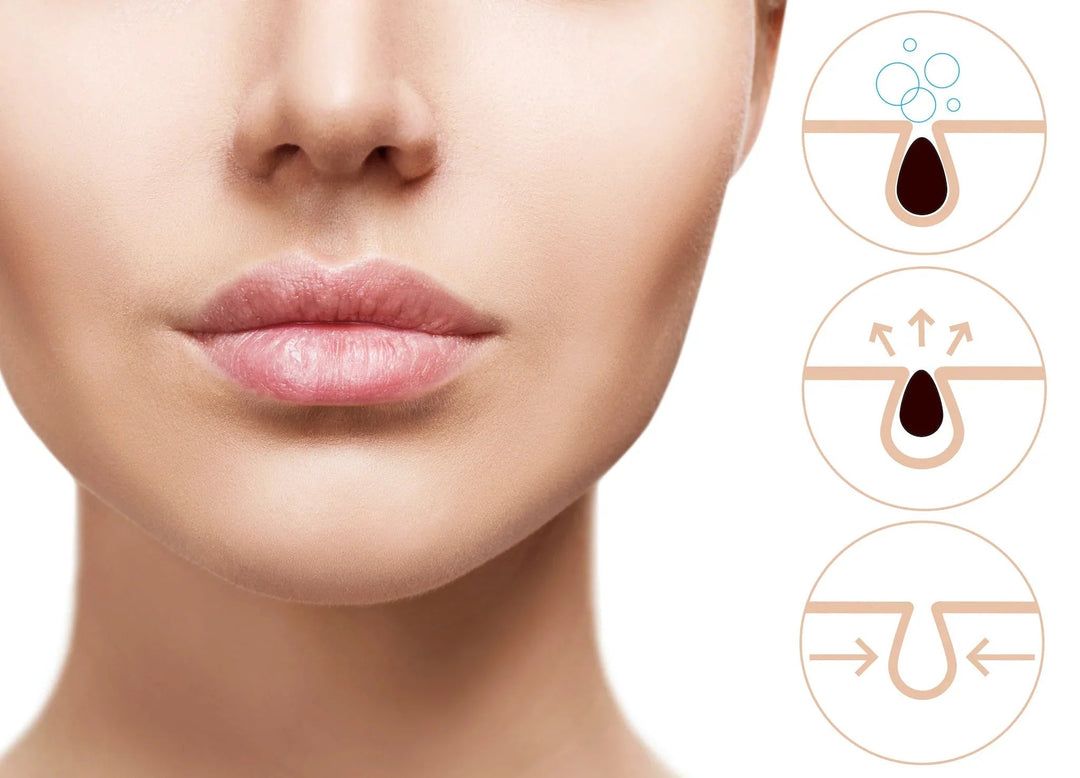 Close-up of a woman's lower face with clear skin and diagrams showing pore cleansing and shrinking steps