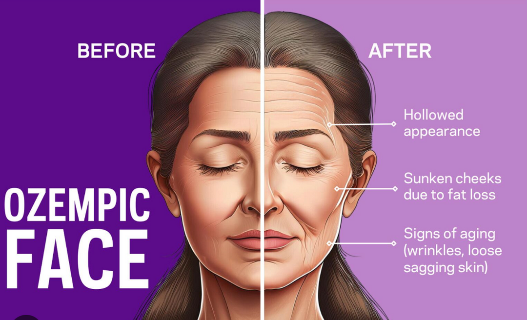 Illustration of the before and after affects on the skin when taking ozempic