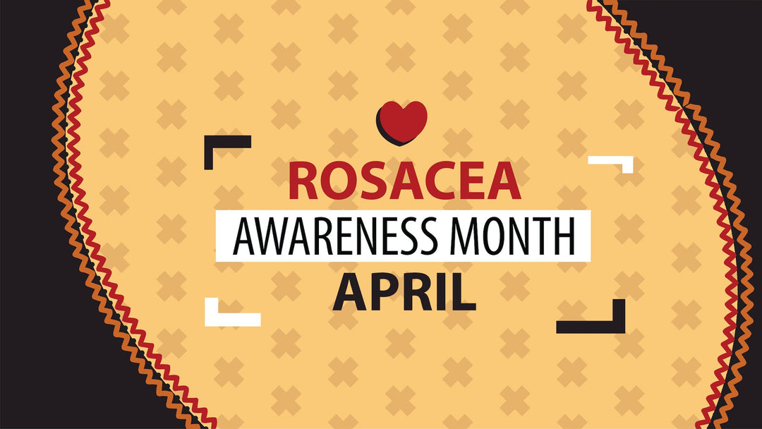 Conquering Rosacea: Your Guide to a Calming Skincare Routine