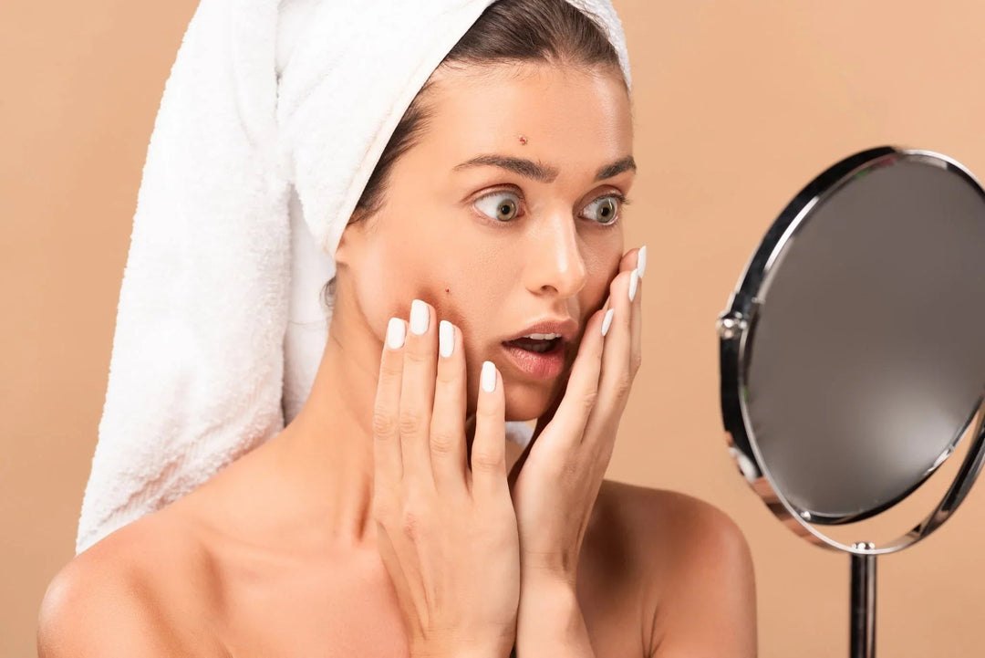 Woman with towel wrapped around head looking shocked at pimples on her face in mirror, skincare concern